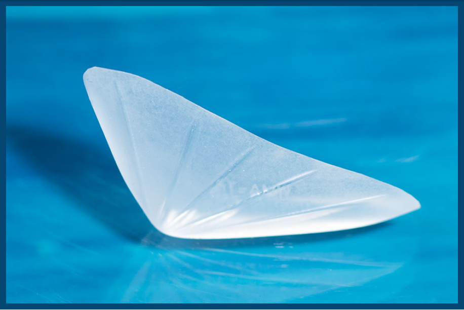 Widening Mandibular Angle Implantat