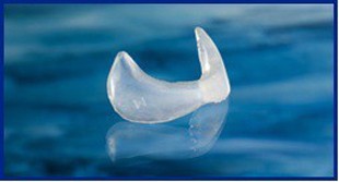 Peri-Pyriform Implantat