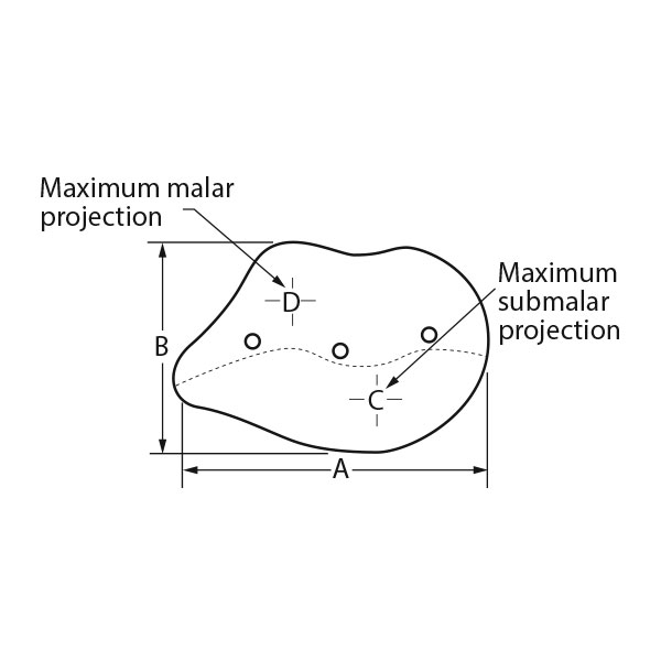 Sizer zu Combined Submalar Shell Implantate