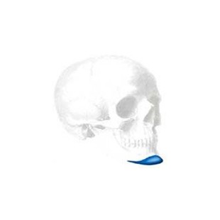 Sizer zu Conform Extended Anatomic Kinn Implantate