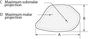 Sizer zu Conform Midfacial Implantate