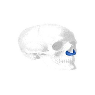 Peri-Pyriform Implantat, Small