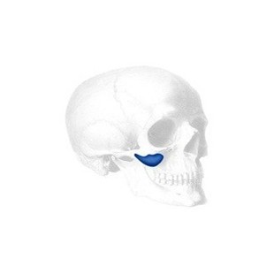 Sizer für Binder Submalar II Facial Implantate
