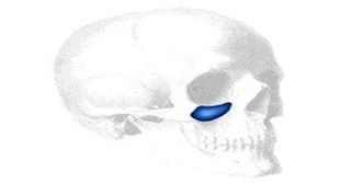 Sizer zu Flowers Tear Trough Implantate