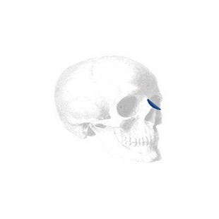 Sizer zu Flowers Dorsal Nasal Implantate