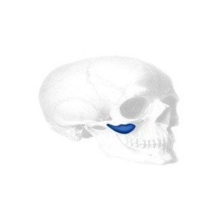 Sizer für Binder Submalar Facial Implantate
