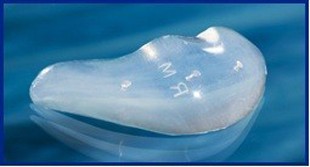 Binder Submalar II Facial Implantat