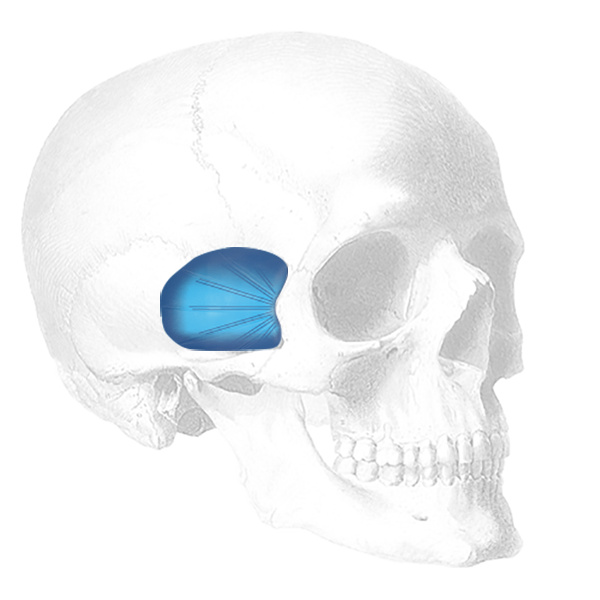 Temporal Shell Implantat, rechts