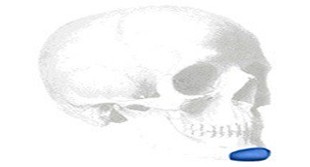 Sizer zu Curvilinear Silicone Kinn Implantate